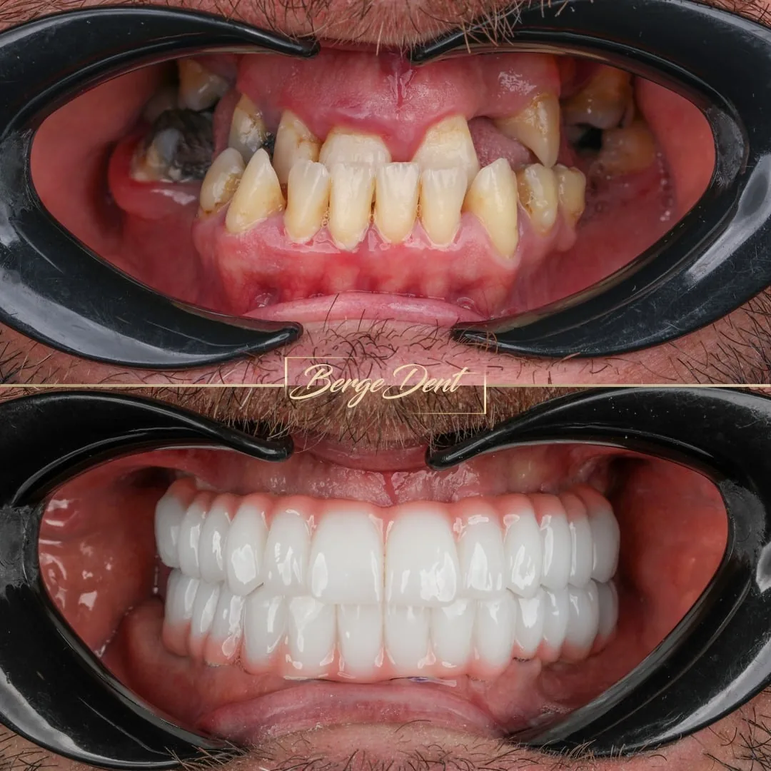 How to Choose a Dental Clinic in Turkey: A 7-Point Checklist