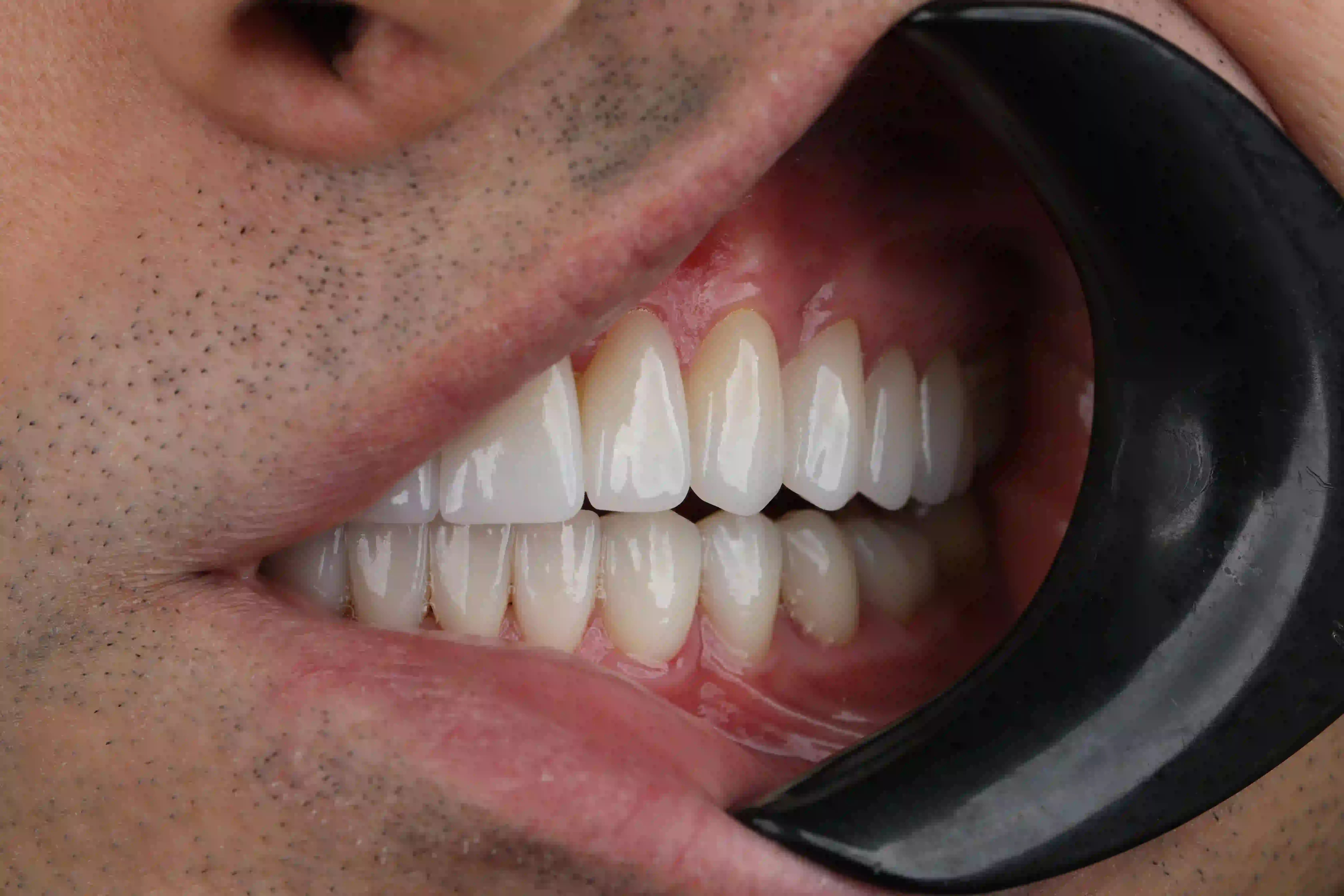 Best dental clinic Turkey